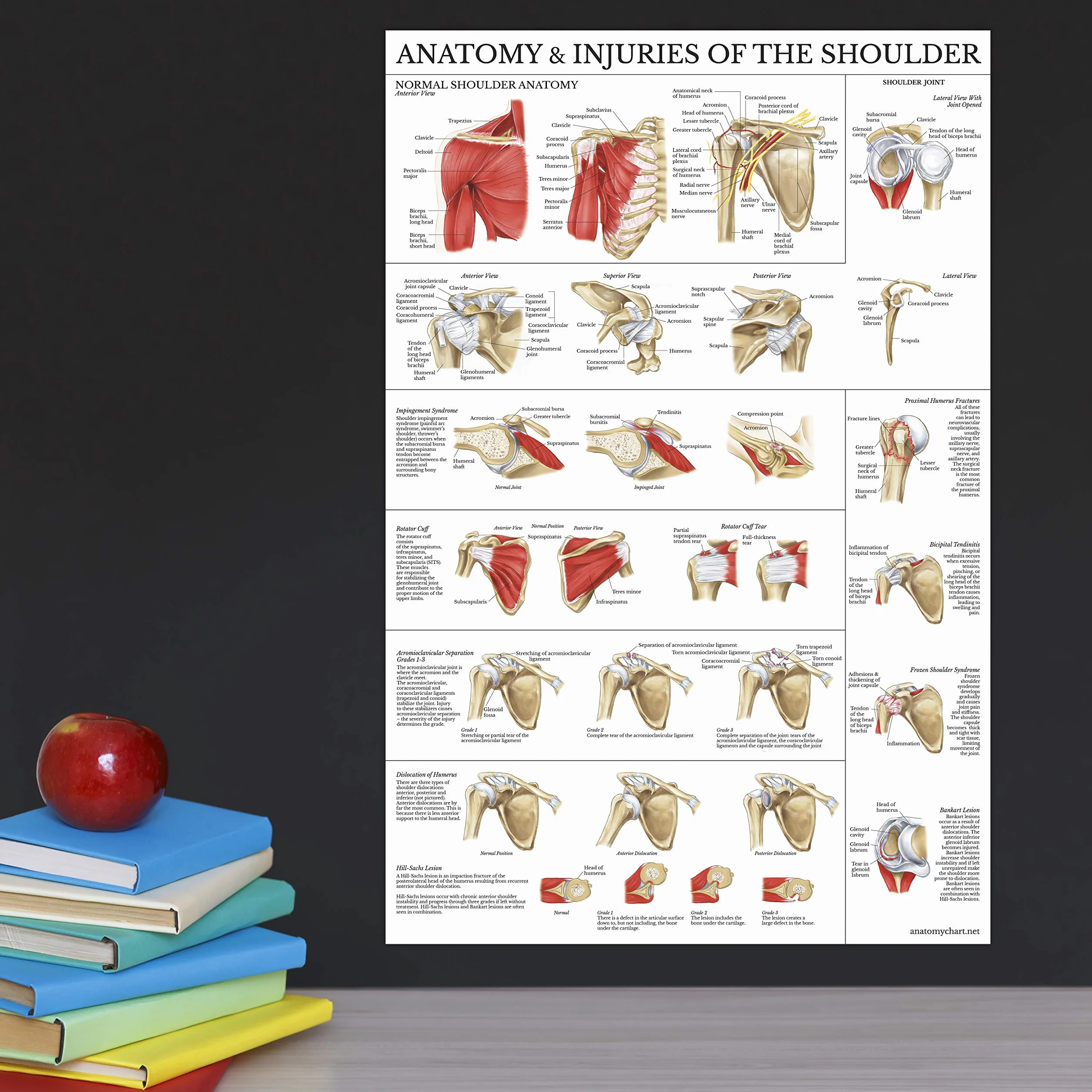 Palace Learning Zestaw 2 plakatów z anatomią i urazami kolana i ramion – zestaw wykresów anatomicznych – laminowany 45 cm x 61 cm