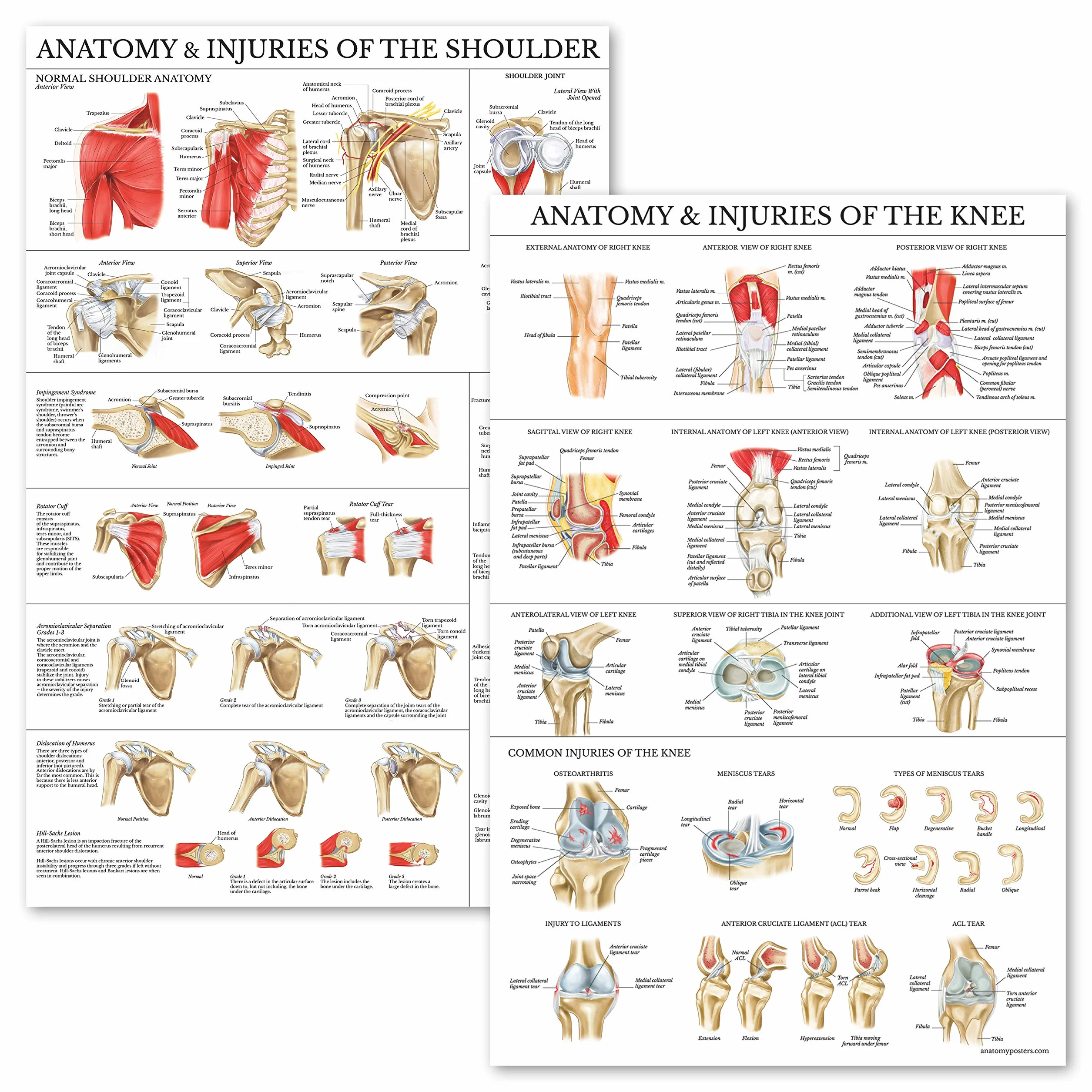 Palace Learning Zestaw 2 plakatów z anatomią i urazami kolana i ramion – zestaw wykresów anatomicznych – laminowany 45 cm x 61 cm