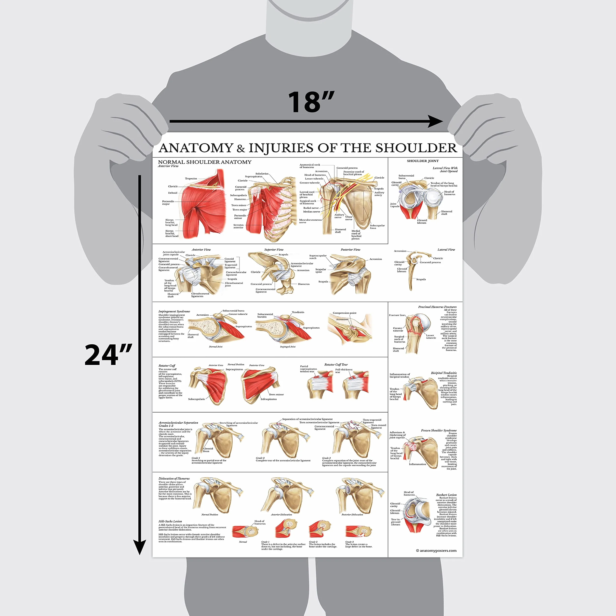 Palace Learning Zestaw 2 plakatów z anatomią i urazami kolana i ramion – zestaw wykresów anatomicznych – laminowany 45 cm x 61 cm