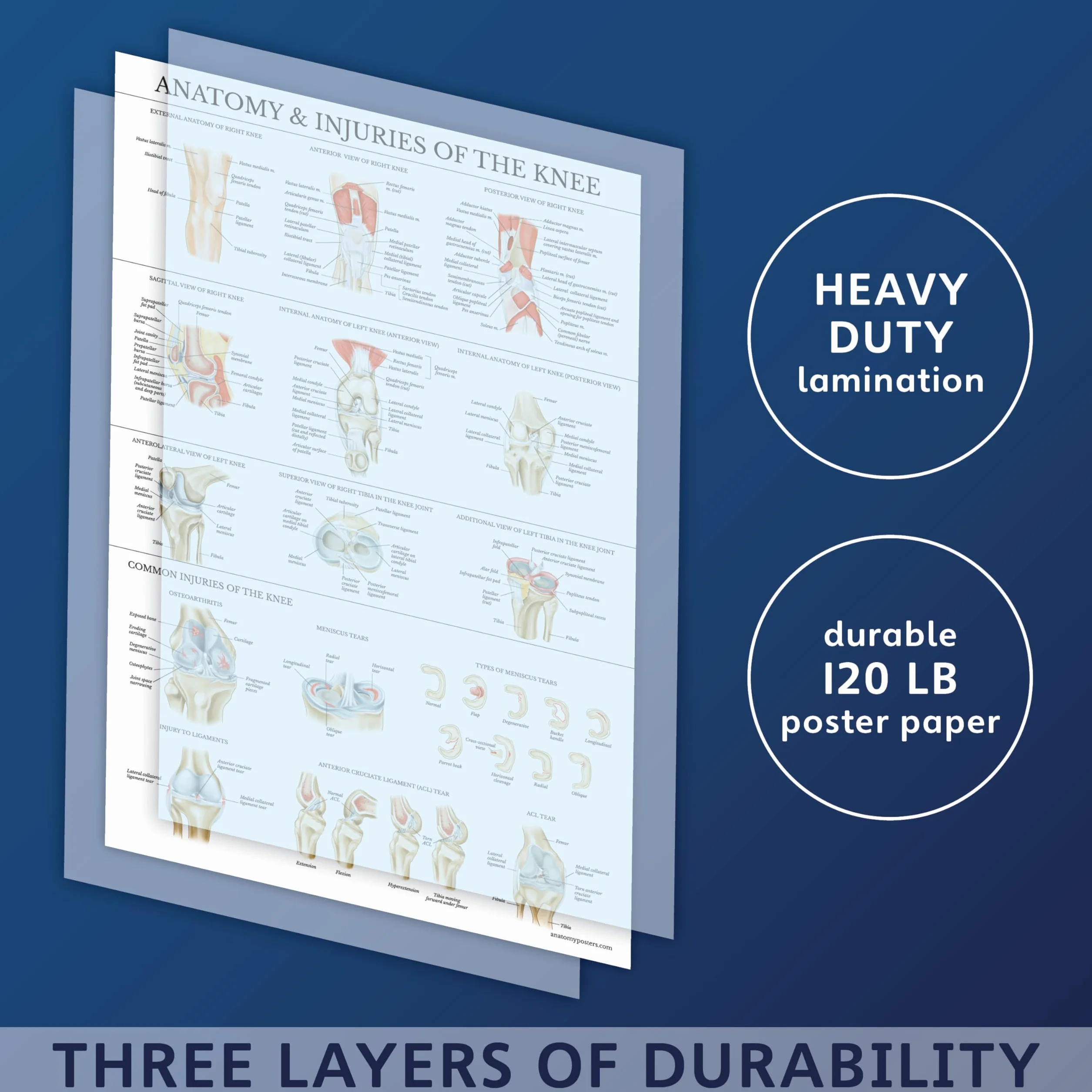 Palace Learning Zestaw 2 plakatów z anatomią i urazami kolana i ramion – zestaw wykresów anatomicznych – laminowany 45 cm x 61 cm
